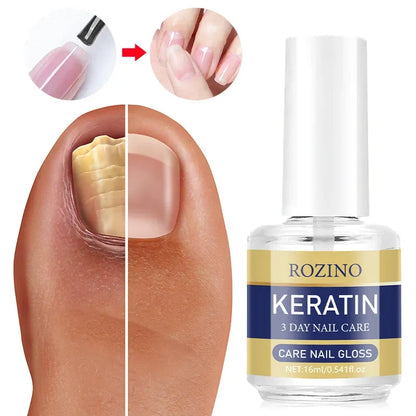 Nail Nutrition Oil – Keratin 3-Day Revitalizing Nail Care 16ml